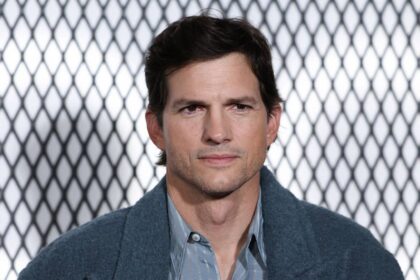 A-listers who have incredibly rare physical traits – including Ashton Kutcher