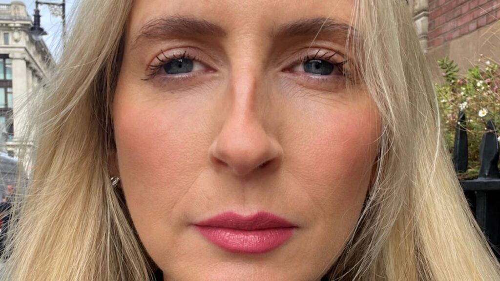 Trying lip filler for the first time at 48